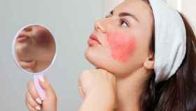Casi el 20% de la población es alérgica a algún componente de los cosméticos.