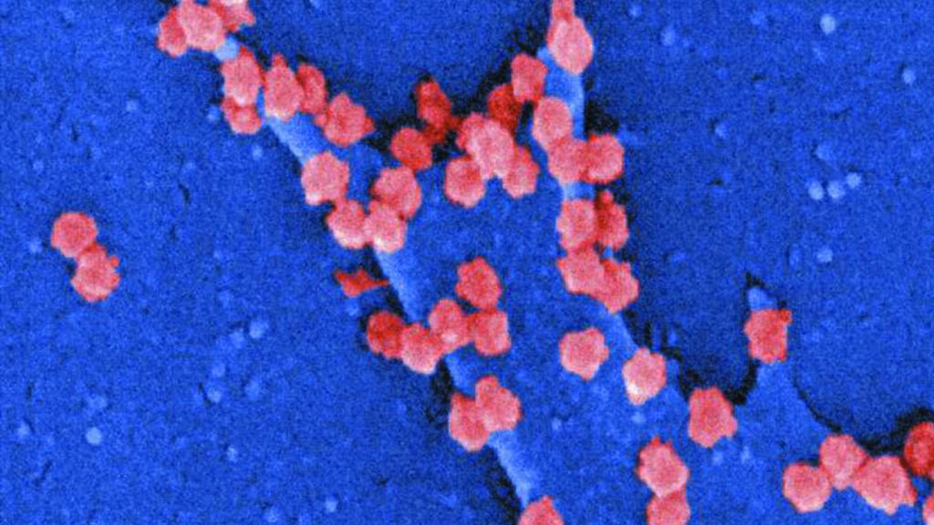 Célula infectada por coronavirus