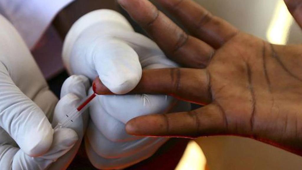 Muestra de sangre para diagnosticar la presencia de VIH.