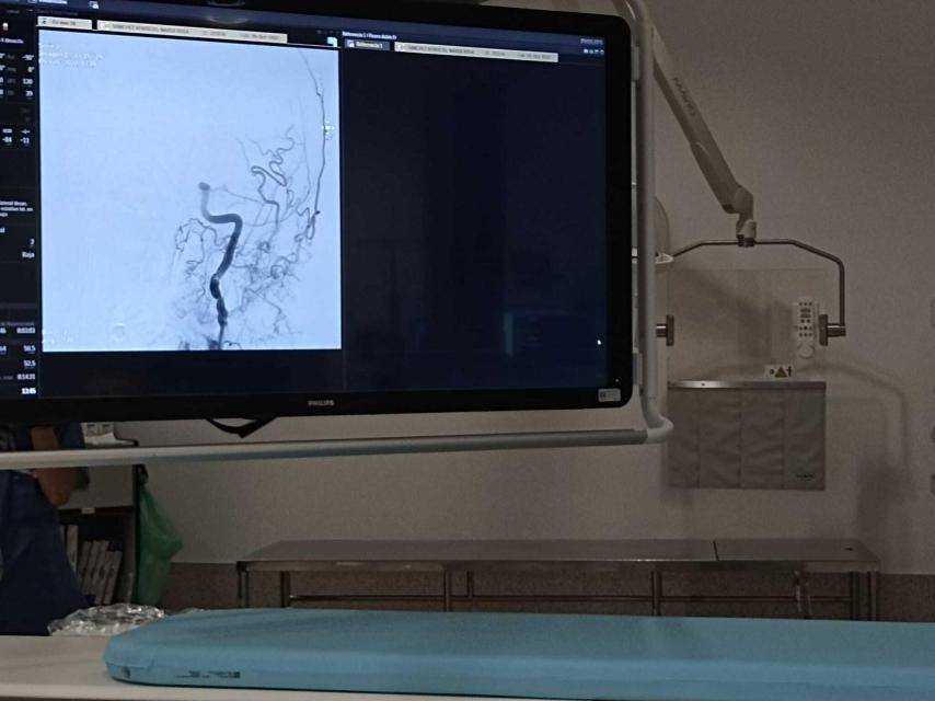 Un escáner a un paciente en el tratamiento por trombectomía mecánica en el Hospital de Salamanca