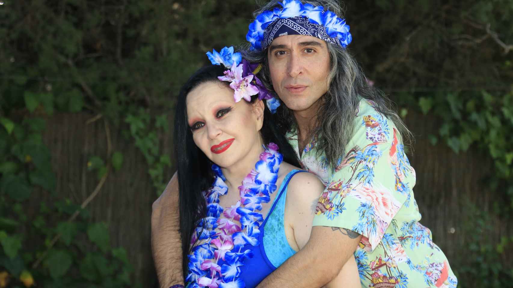 Tanto Alaska como su marido, Mario Vaquerizo, se alían a los tratamientos estéticos para mejorar su imagen.