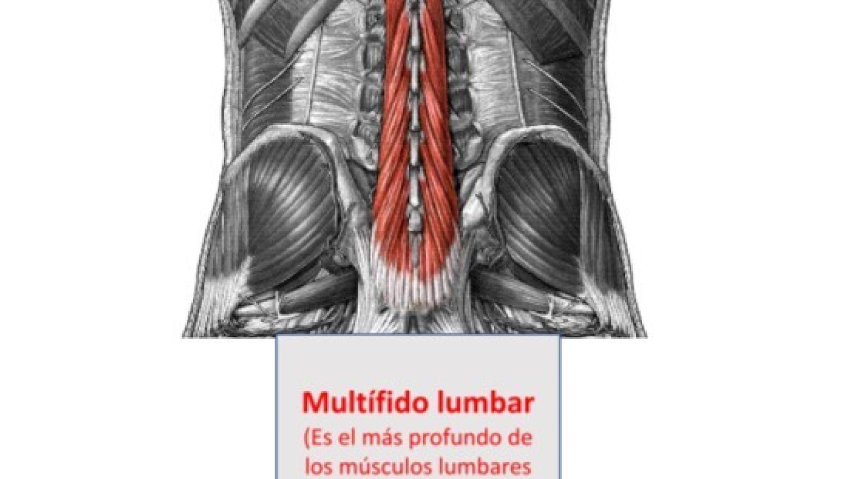 El multifido lumbar, señalado en la espalda.