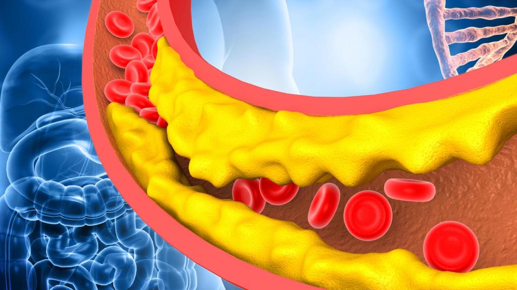 La acumulación de colesterol en los vasos sanguíneos es fuente de numerosos problemas.