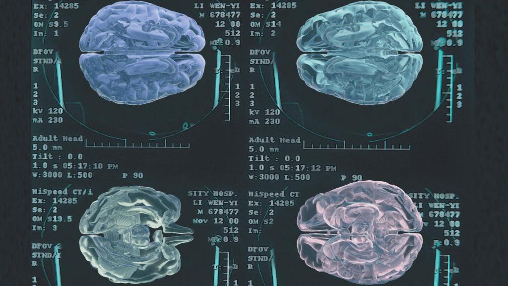 Neurología.