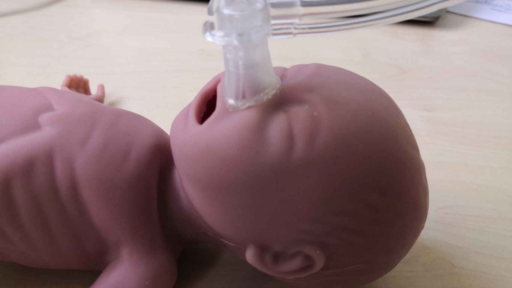 La mascarilla impresa en 3D para un bebé prematuro. FOTO: Hospital Clínic de Barcelona.