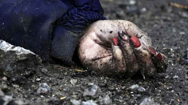 Detalle de la mano de un cadáver en la ciudad ucraniana de Bucha.
