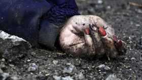 Detalle de la mano de un cadáver en la ciudad ucraniana de Bucha.