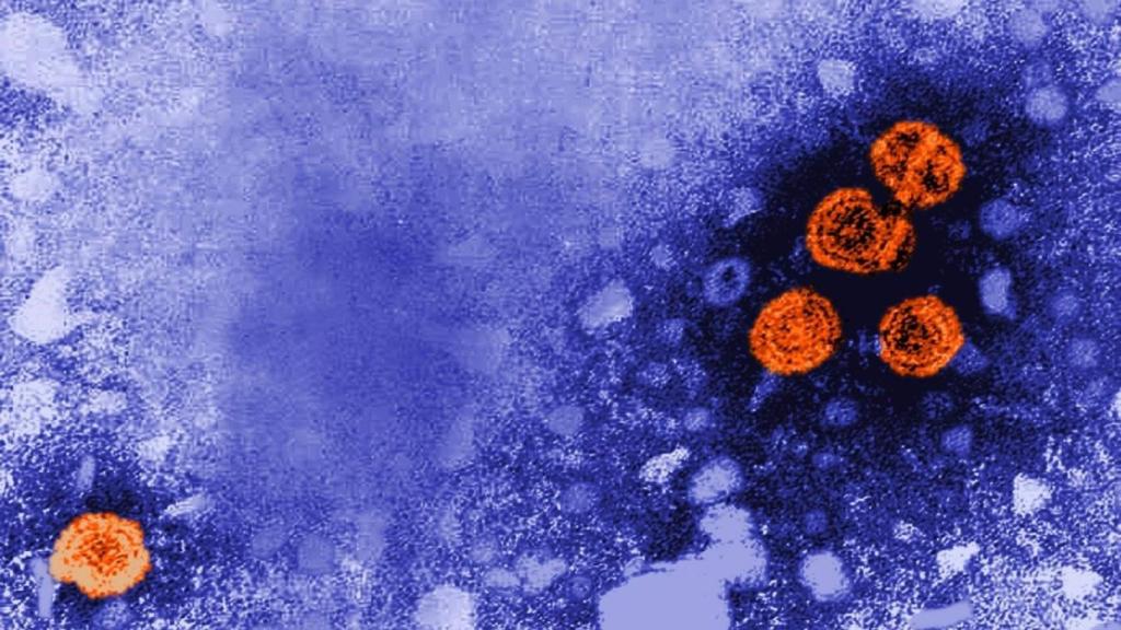 Imagen de microscopía electrónica de transmisión coloreada digitalmente revela la presencia de viriones de la hepatitis B.