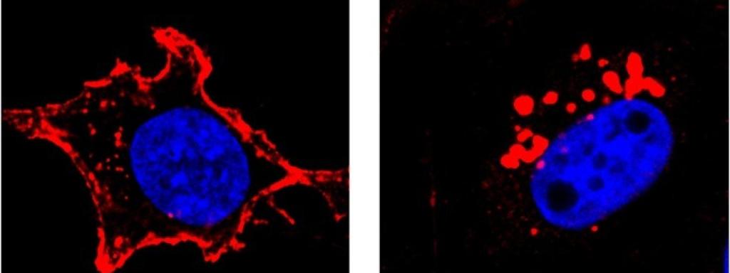 Imagen investigación cáncer de mama. Usal