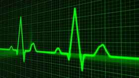 Gráfico de un electrocardiograma. IMAGEN: Pixabay.
