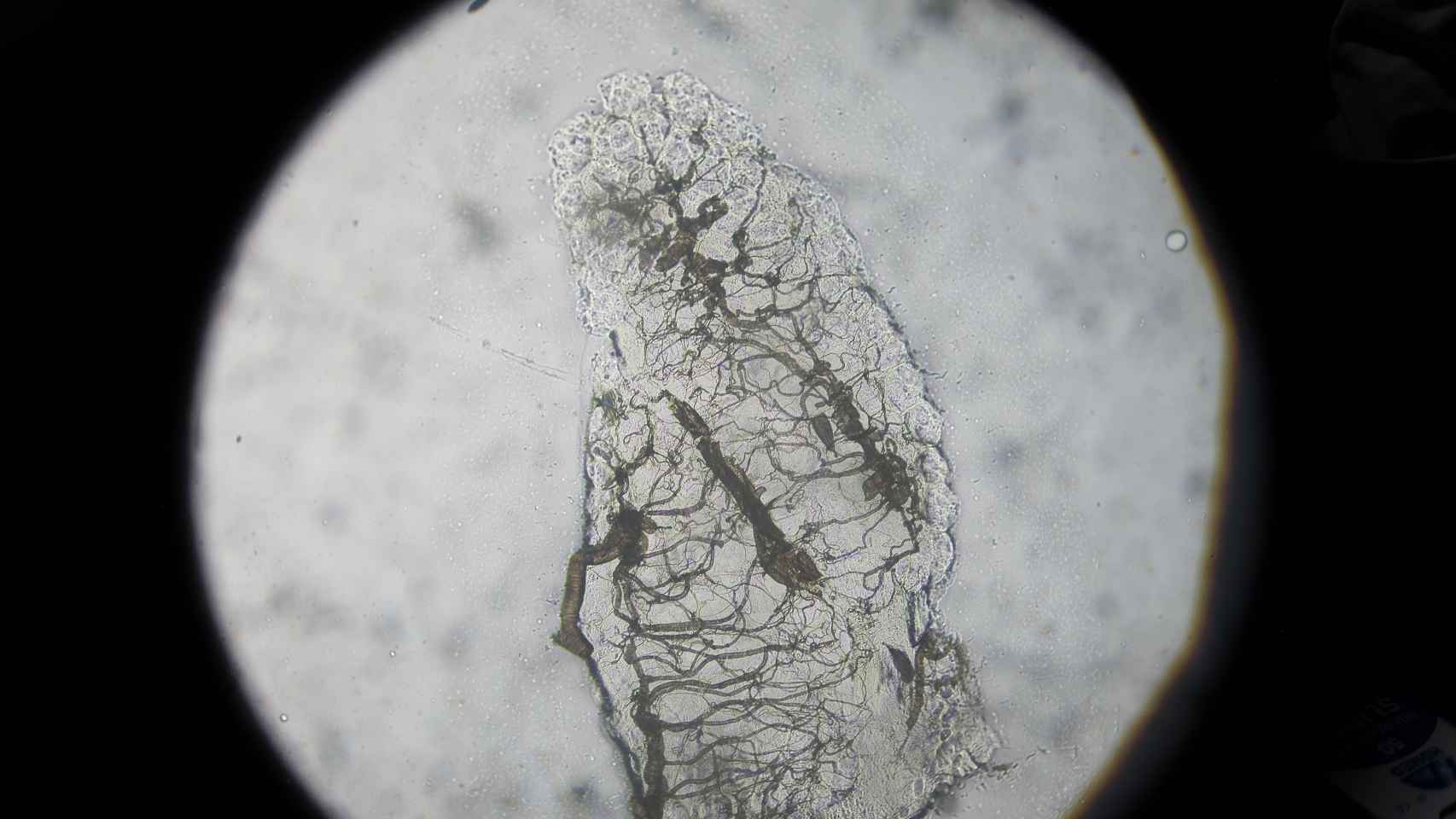 Vista a través del microscopio del ovario de un mosquito Anopheles que ya ha puesto huevos.