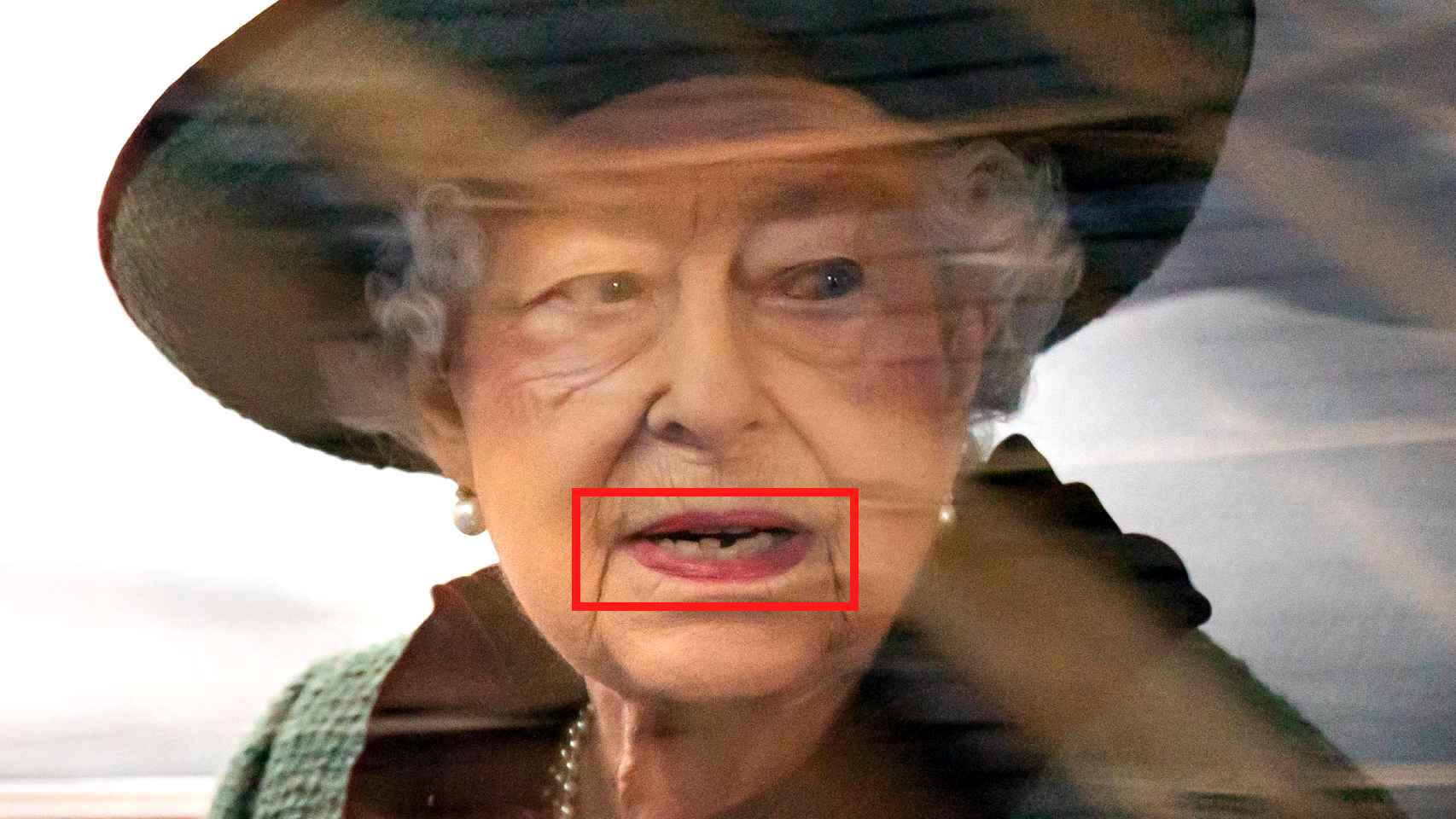 La Reina muestra un apiñamiento severo en la zona inferior de su dentadura.