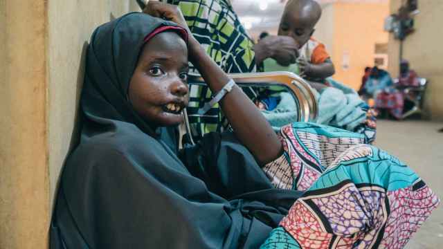 Amina, una paciente de 18 años con NOMA en el hospital de Sokoto, en 2016.