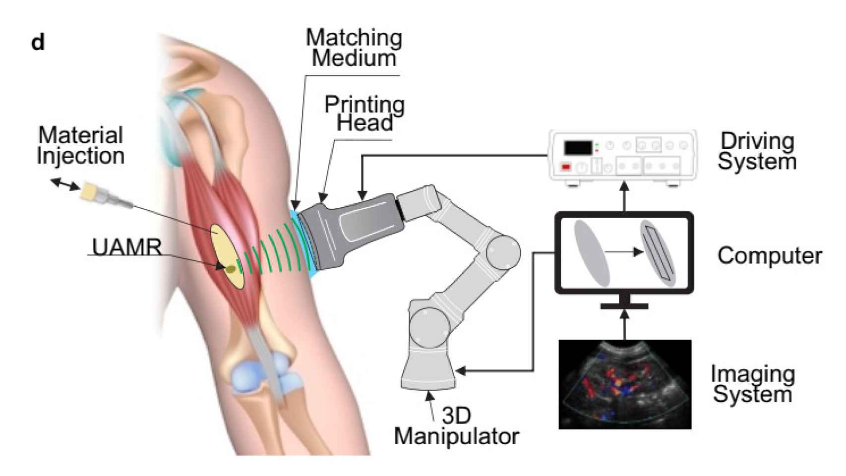Implantes 3D formados con ultrasonidos