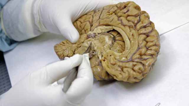 Un investigador manipula la maqueta de un cerebro.
