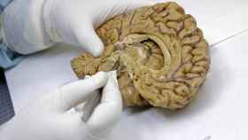 Un investigador con un bisturí y la maqueta de un cerebro entre manos.