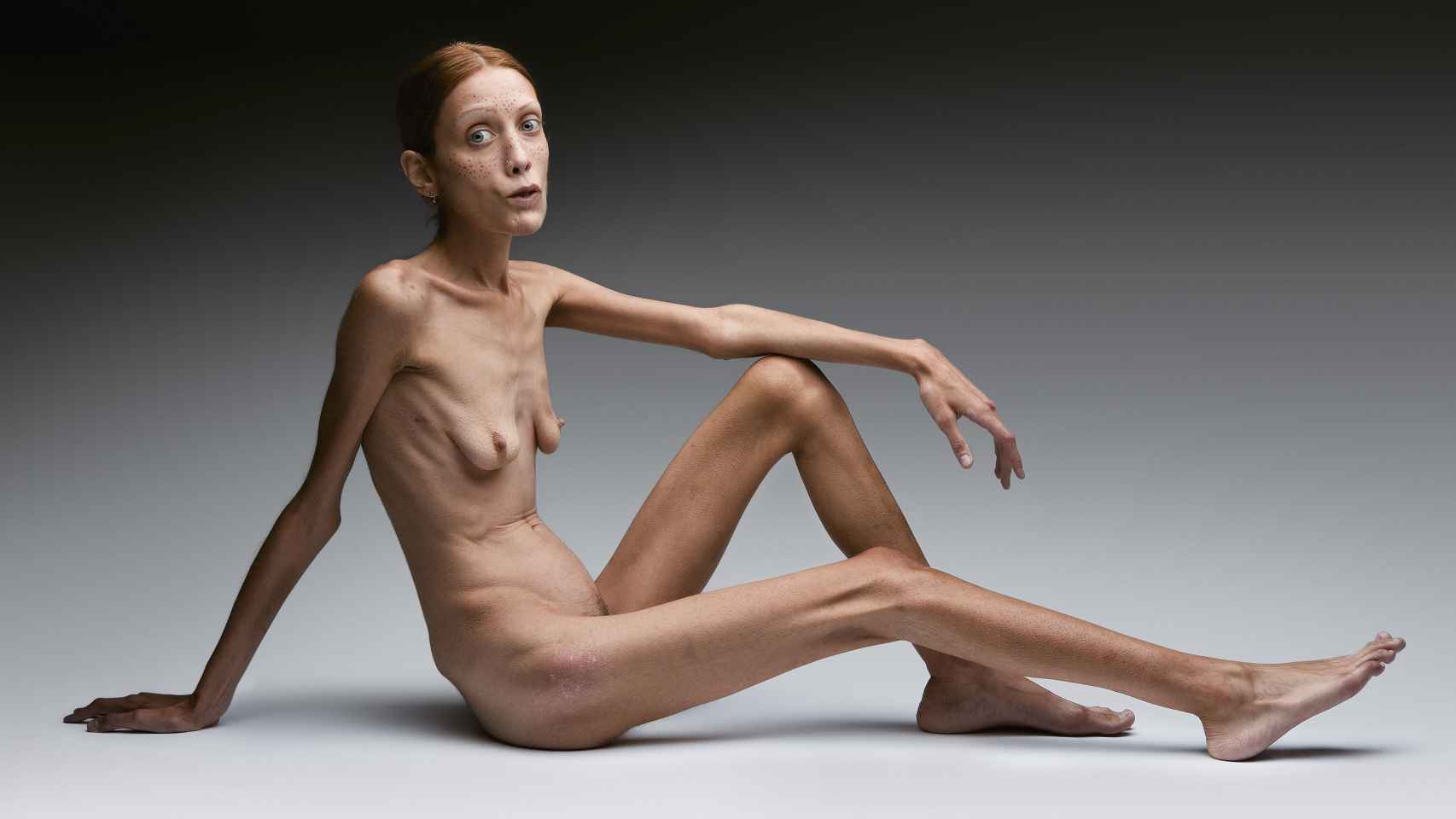 Campaña 'Anorexia'.