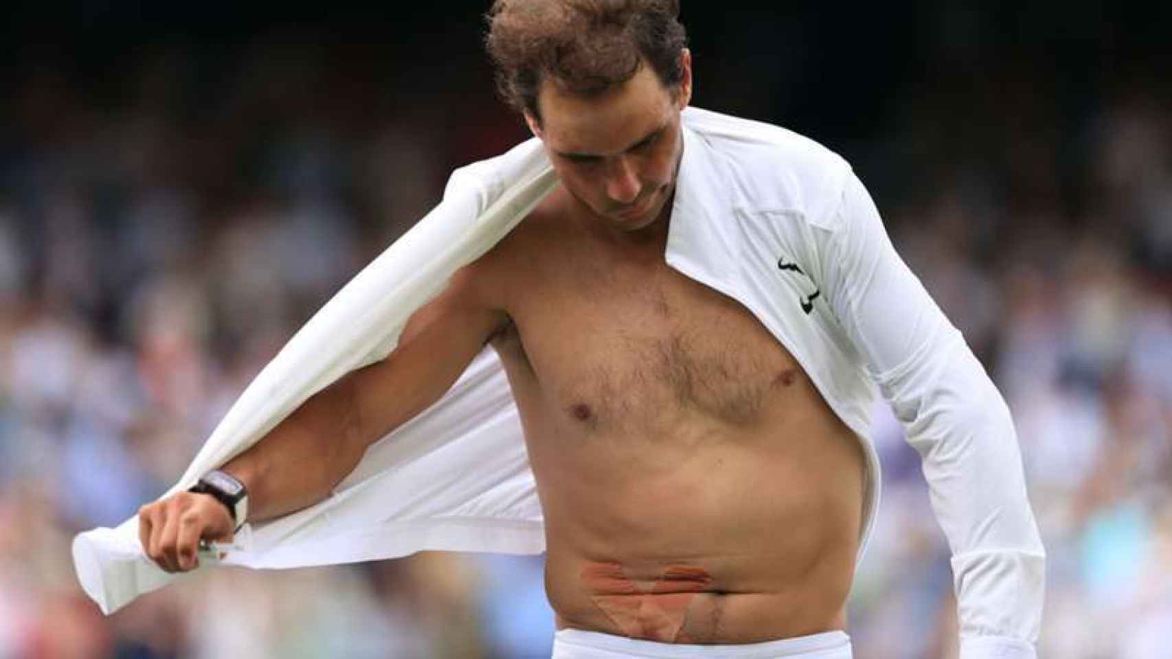 Así es la lesión en el abdomen de Rafa Nadal que ha provocado su retirada en Wimbledon