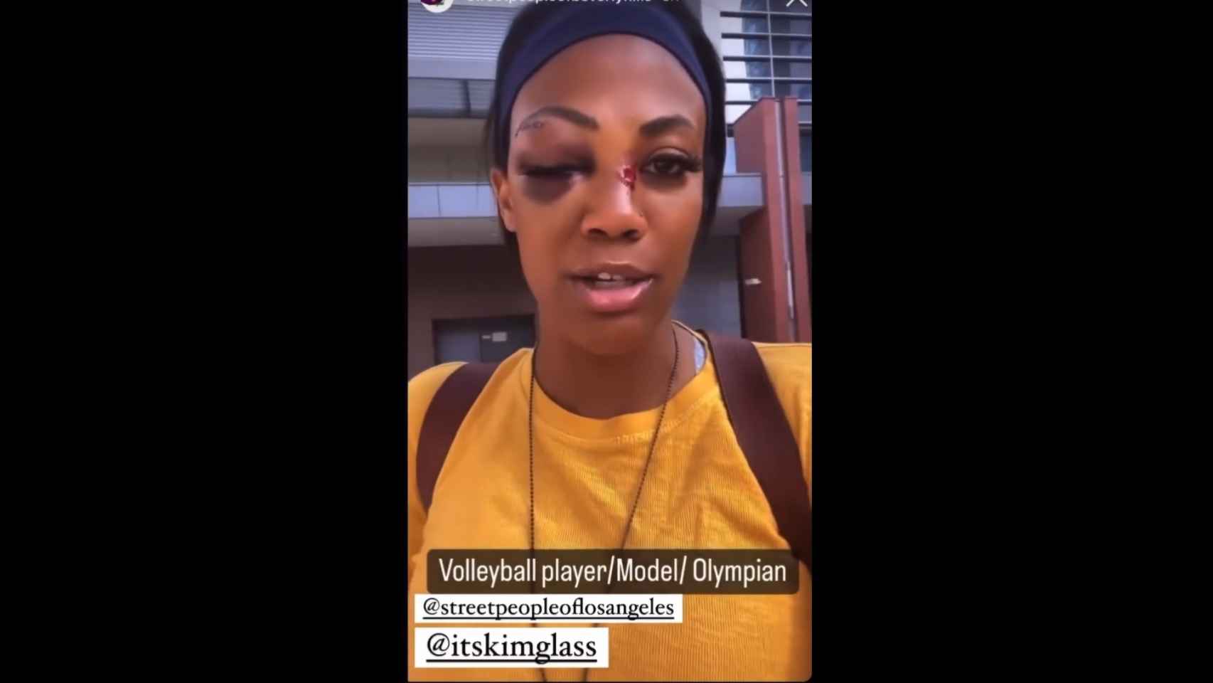 Brutal ataque a Kim Glass, medallista olímpica, por parte de un sin techo con una barra de metal