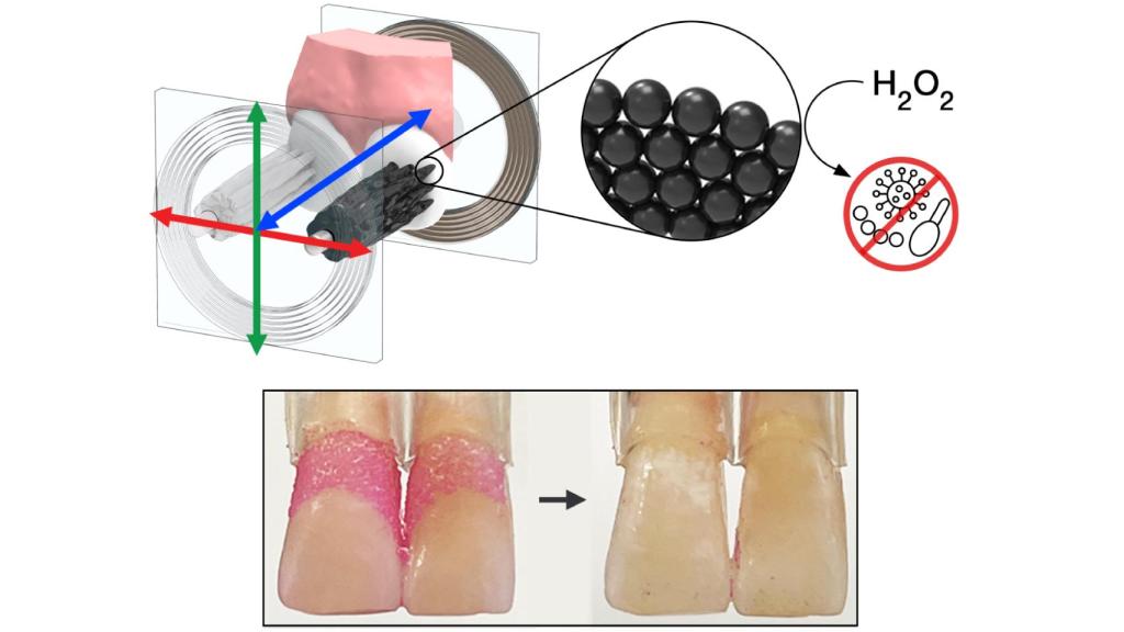 Estos microrobots cambian de forma para limpiar los dientes.