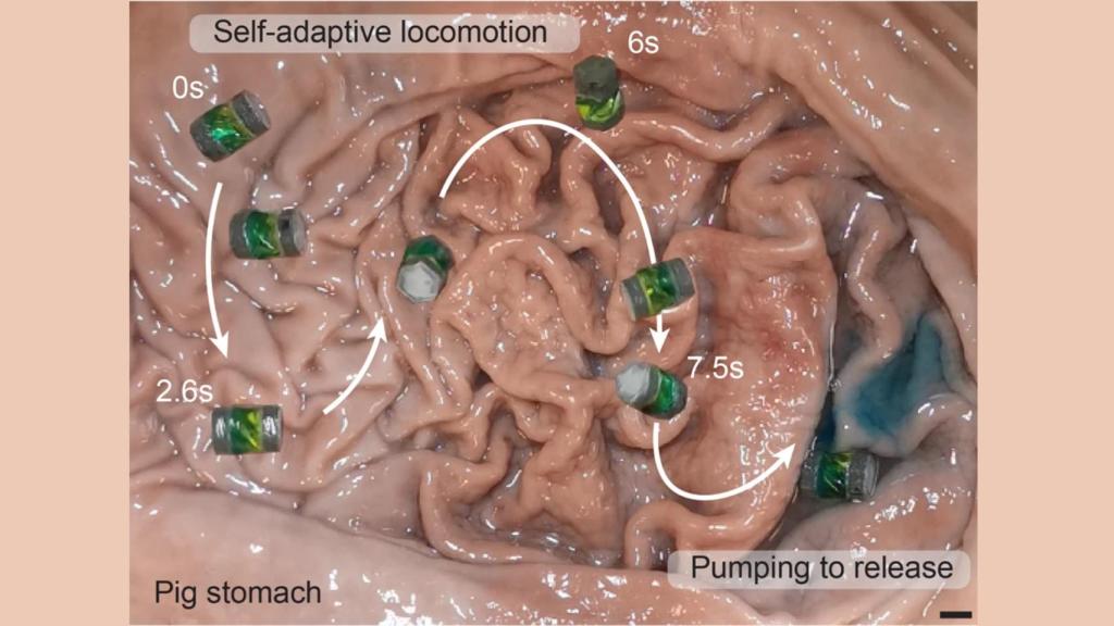 Los microrobots en acción en el estómago de un cerdo.