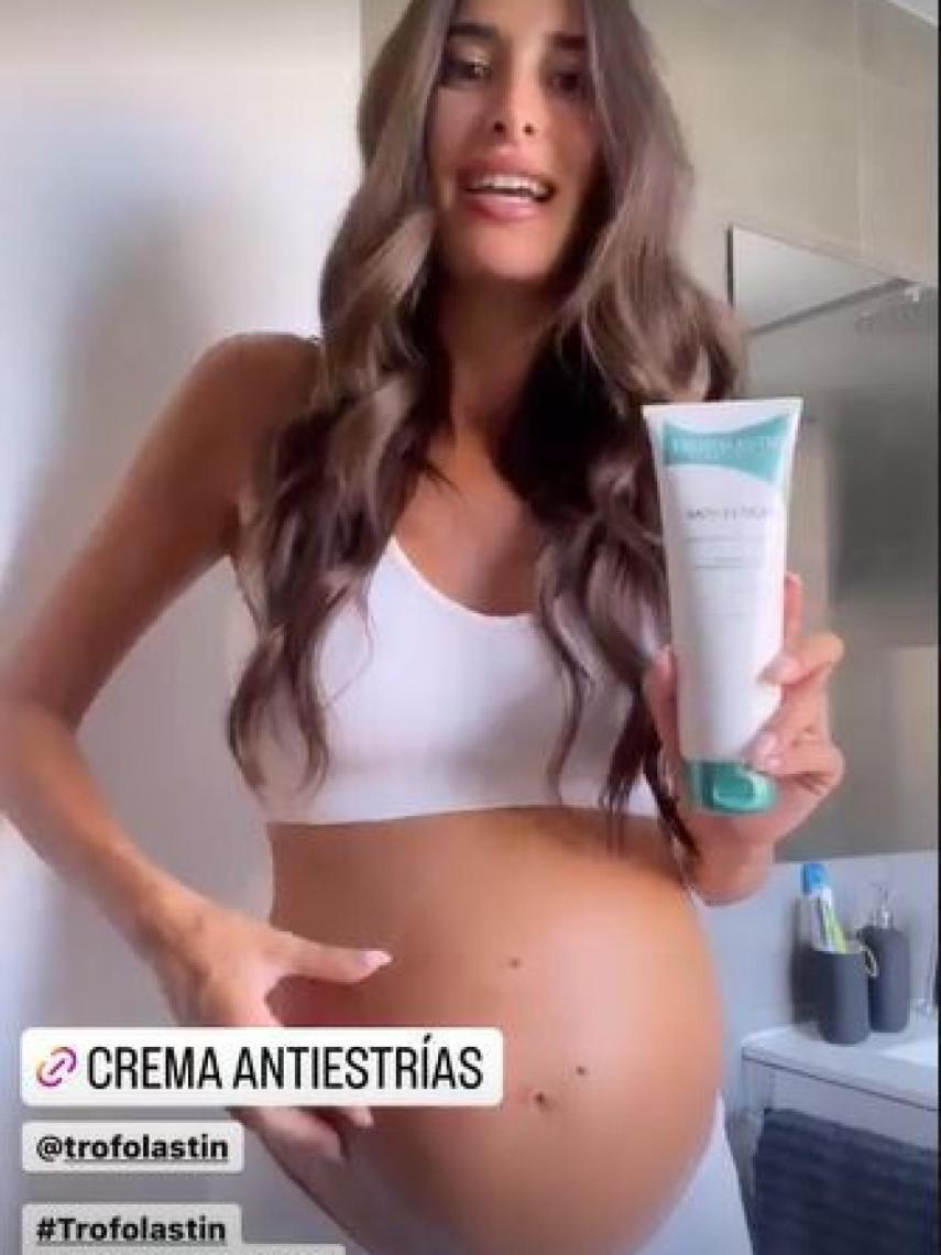 Lidia Torrent está utilizando una crema para prevenir la aparición de estrías.