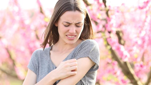 Una mujer se rasca un brazo irritado por la contaminación.