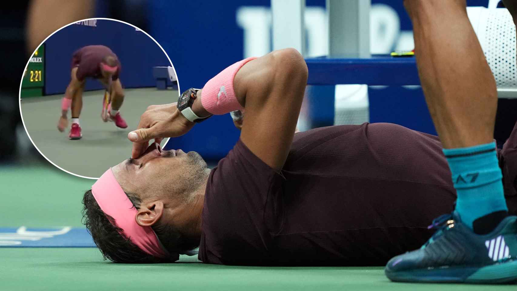 El golpe en la nariz de Rafa Nadal durante el US Open