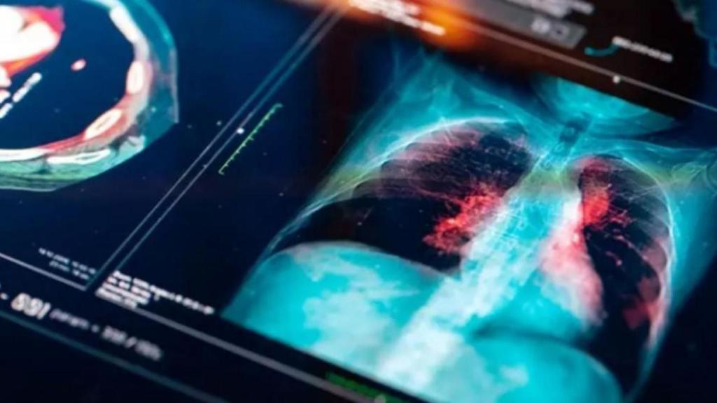 La identificación de biomarcadores es crucial para evitar interrupciones prematuras del tratamiento.