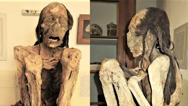 Imagen de la momia masculina conservada en Alemania / A-M Begerock et al.
