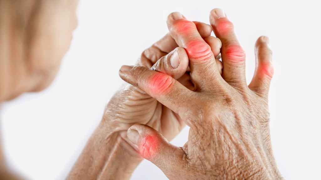 Los dolores en las articulaciones de los dedos son uno de sus principales síntomas.