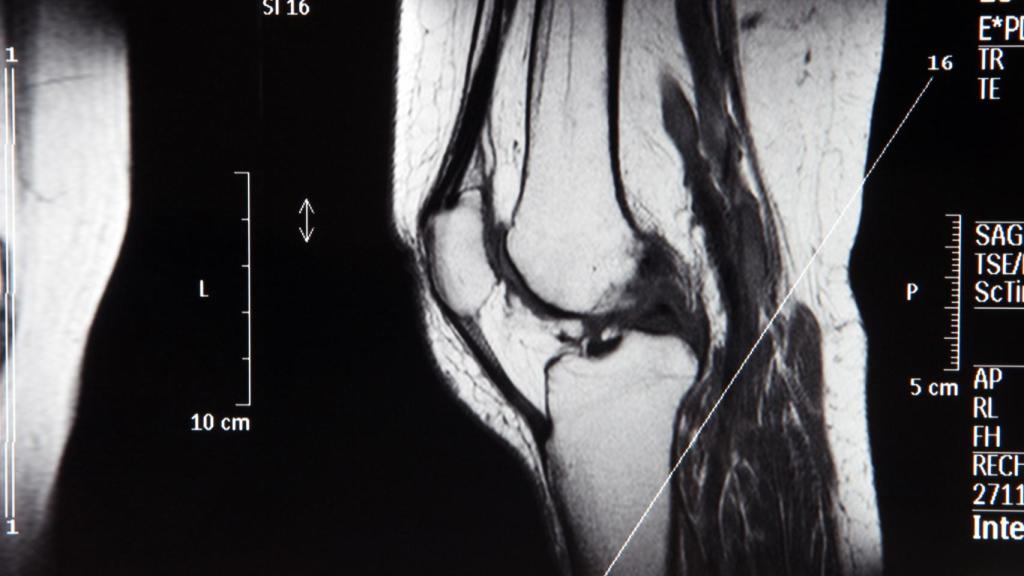 Una prueba de imagen de la rodilla.