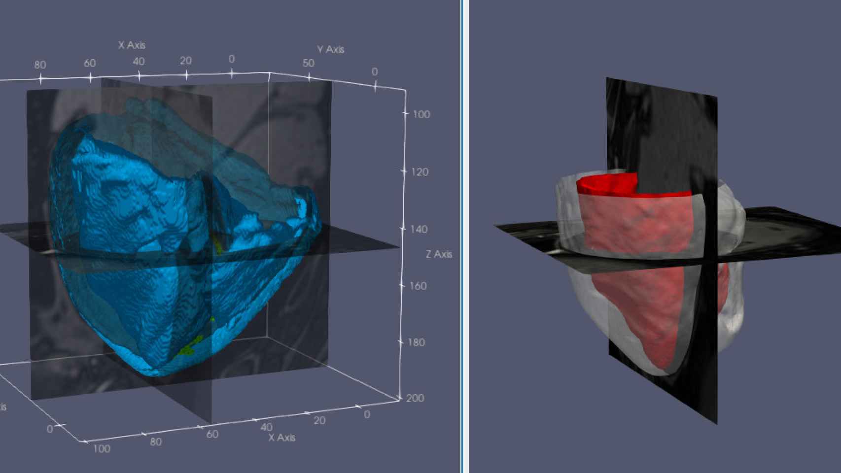 Imagen en 3D del corazón que se va a obtener con este nuevo sistema