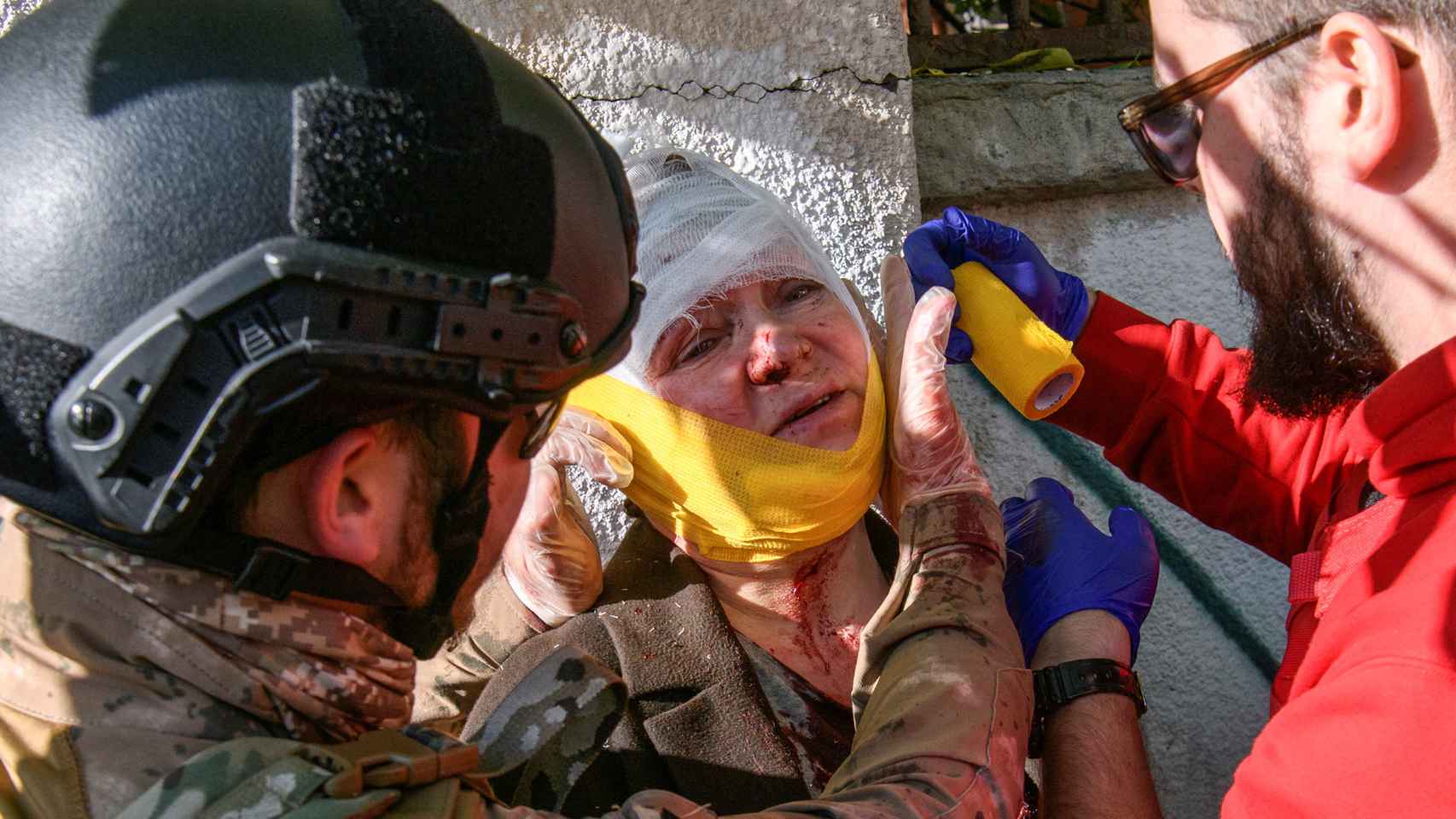 Una mujer herida por los bombardeos rusos de este lunes en Kiev está siendo atendida por médicos.