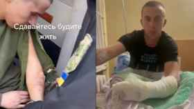 El soldado, antes y después de que su herida haya recibido tratamiento médico.
