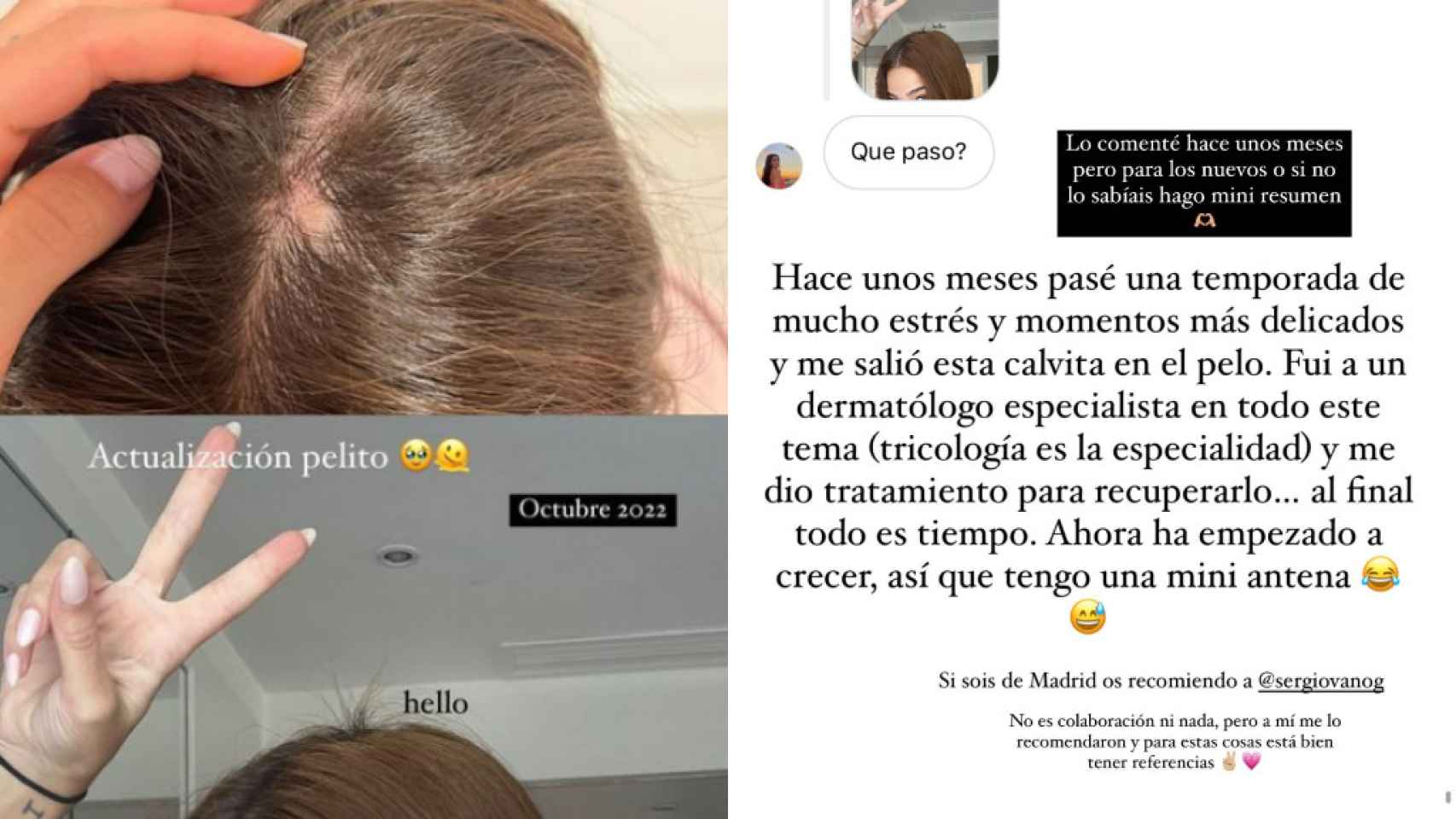 Laura Escanes ha recomendado a su dermatólogo a través de sus redes sociales.