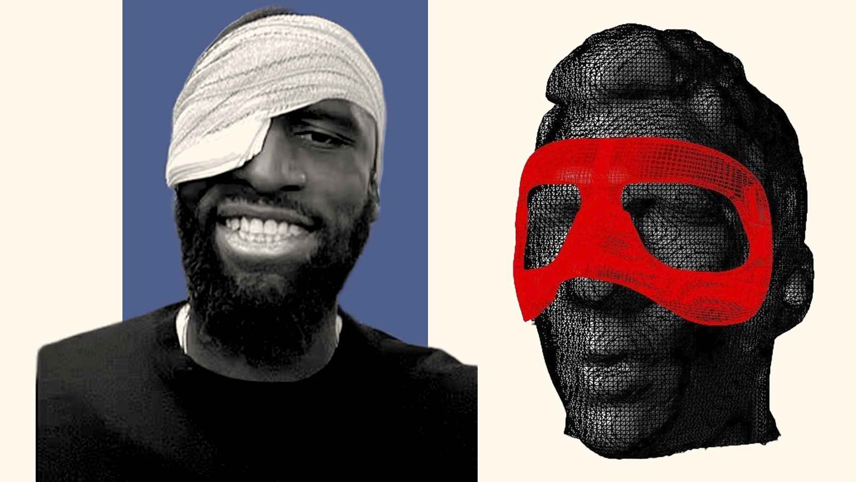 Antonio Rüdiger con el ojo vendado y una recreación 3D de una máscara de protección facial