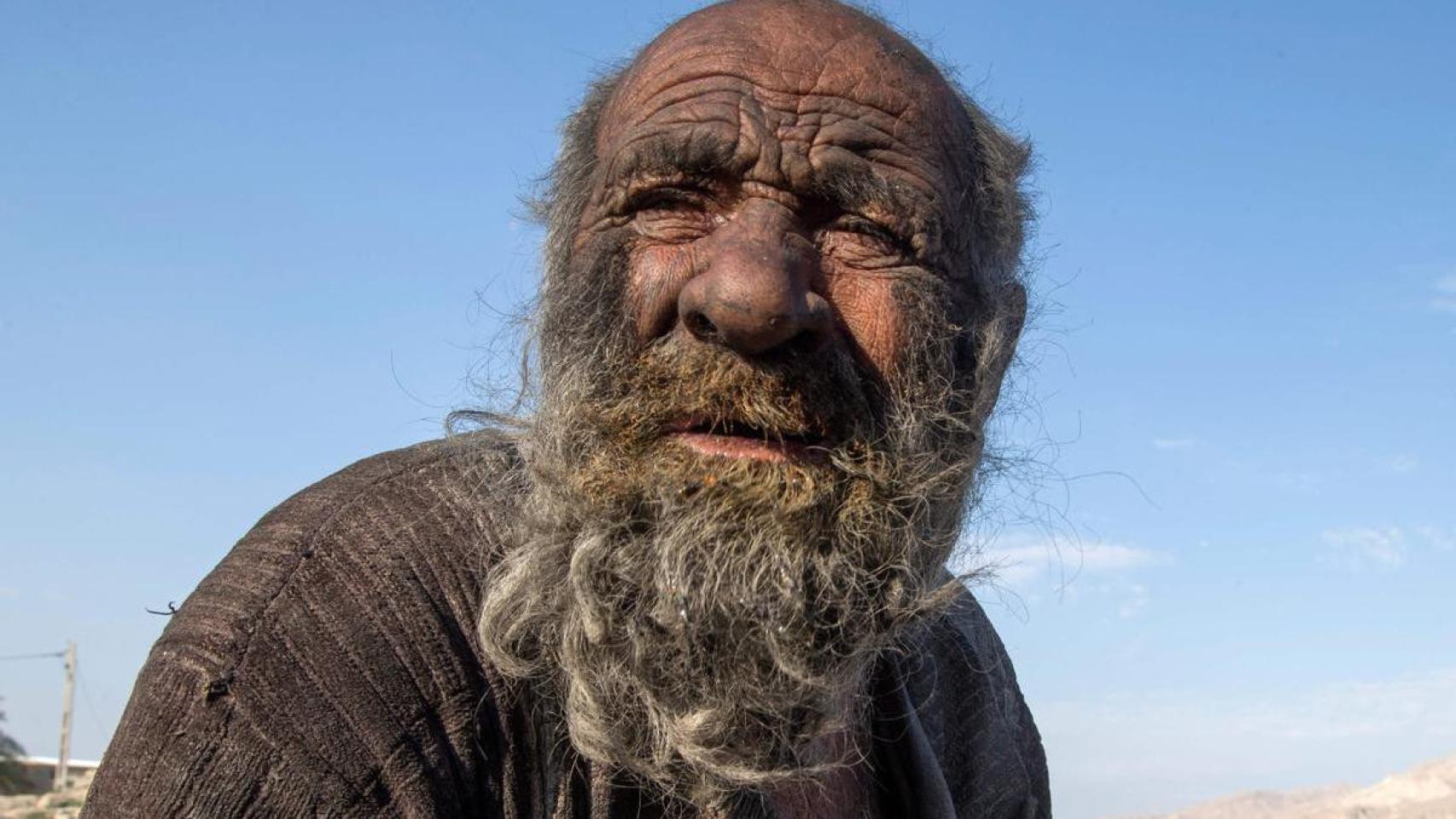 El hombre más guarro del mundo ha muerto y no imaginas por qué