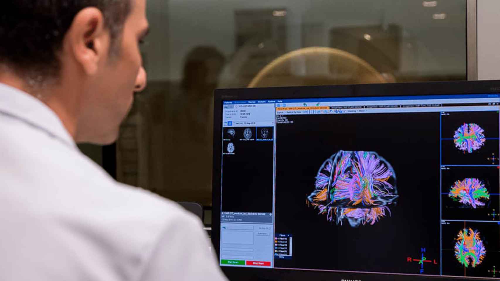 Un técnico de neuroimagen estudiando un escáner cerebral