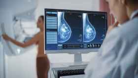 quantusMM es compatible con la mayoría de los mamógrafos actuales.