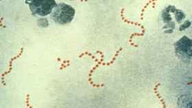 Imagen de la bacteria 'streptococcus pyogenes'