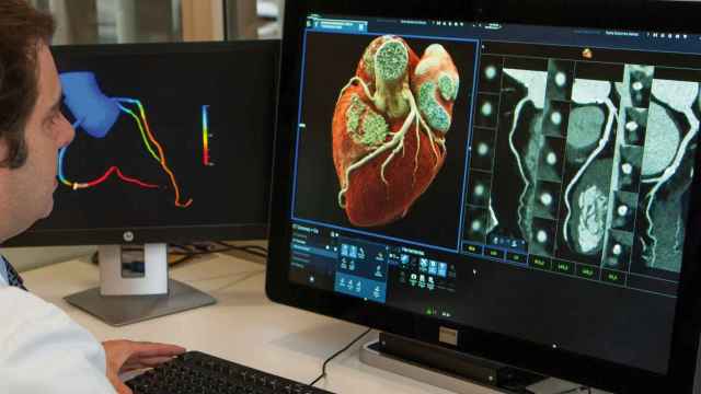 Realización de coronariografía por TAC para la valoración de arterias coronarias.