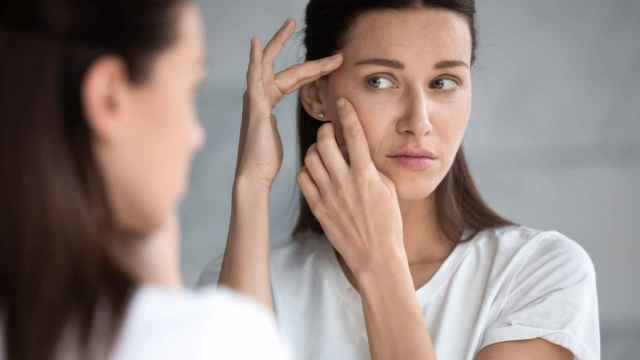 ¿Cómo combatir el acné adulto?