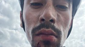 Iván Ramiro Sosa, ciclista de Movistar Team, tras recibir una agresión