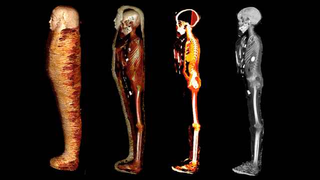 Tomografía computarizada de la momia del niño de oro en cuatro fases. /SN Saleem, SA Seddik, M el-Halwagy