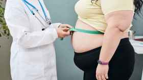 Médica midiendo el contorno a una persona obesa