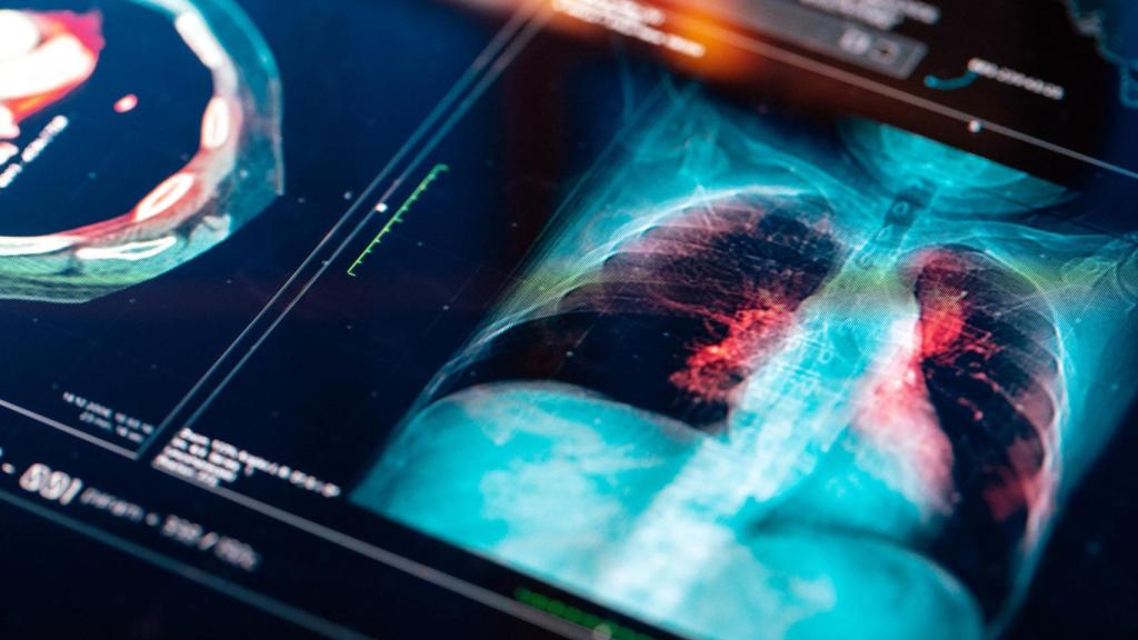 Una prueba diagnóstica por imagen es clave para localizar el cáncer de pulmón.