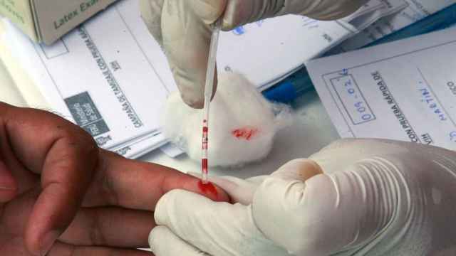 Test de VIH a partir de la gota de sangre de un paciente.