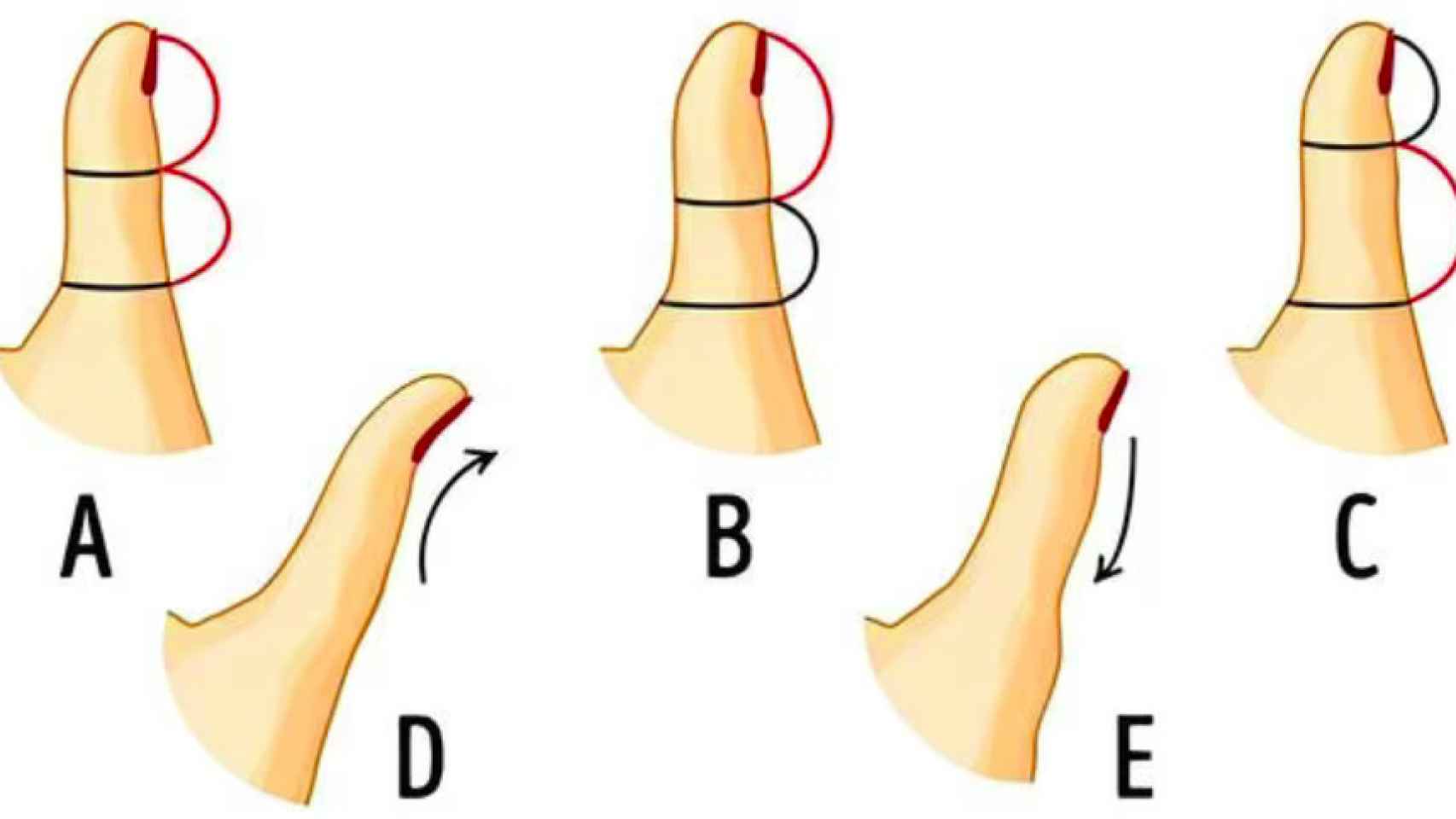 ¿Qué forma tiene tu dedo pulgar?