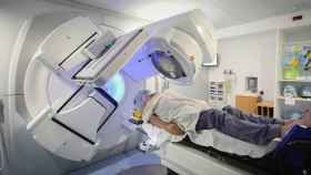 Una persona sometiéndose a una sesión de radioterapia.